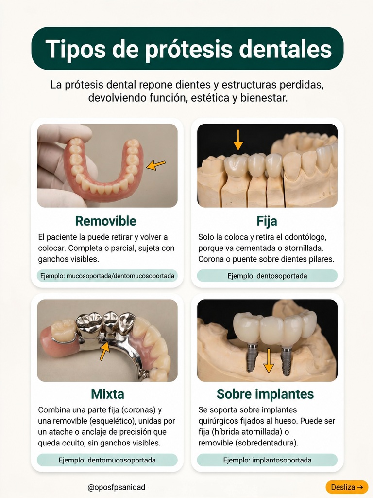 Tipos de prótesis dentales