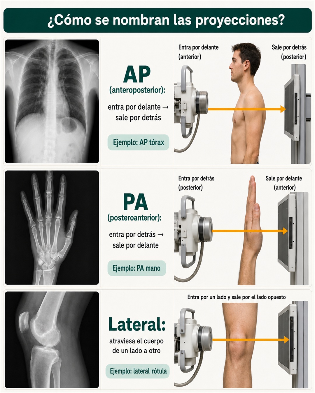 Proyecciones AP, PA y lateral con el posicionamiento del paciente