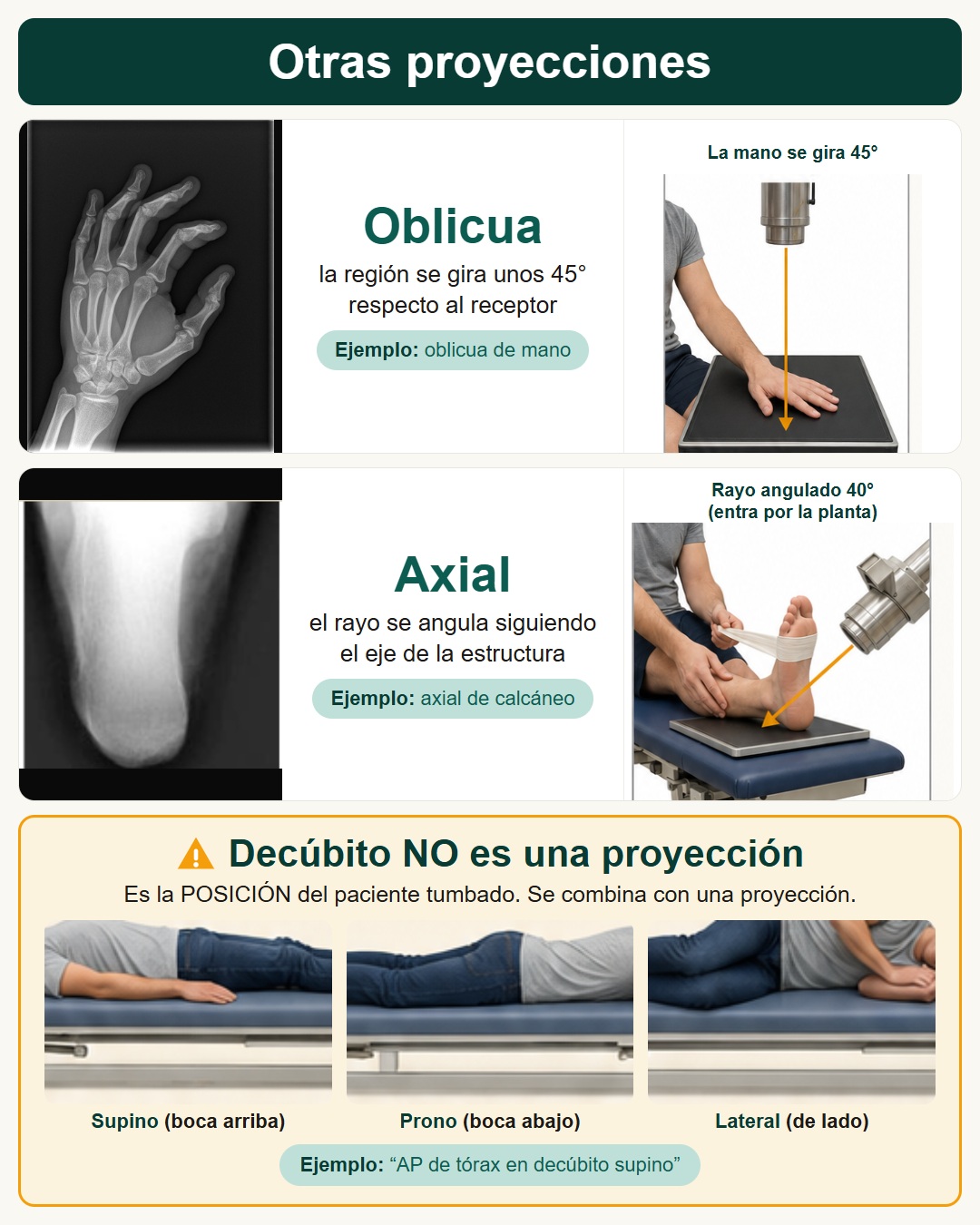 Proyecciones oblicua y axial, y por qué el decúbito no es una proyección